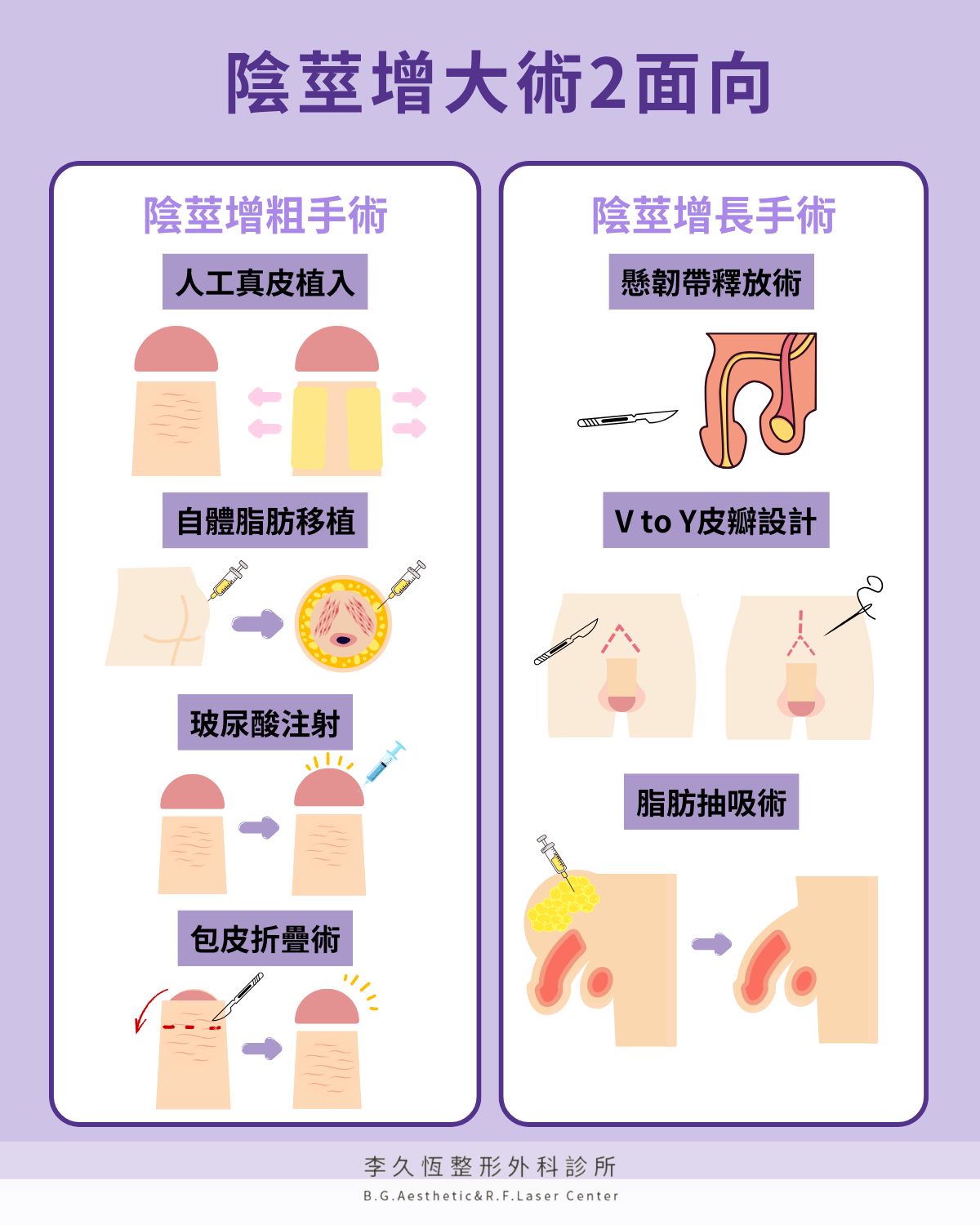 陰莖增大手術2大類
